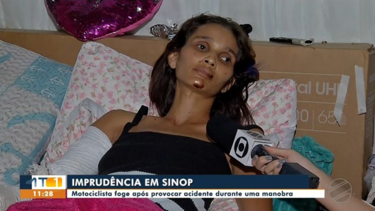 Mulher atropelada na André Maggi por motoqueiro que empinava falou à TV e desabafou: “não consigo dobrar o joelho e até para comer tenho dificuldade”.