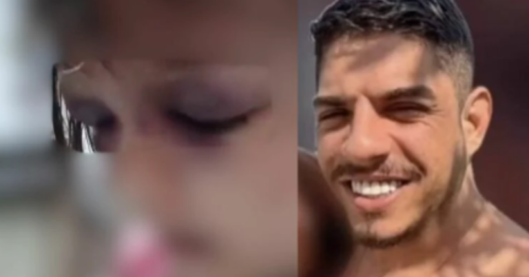Menina de 3 anos é brutalmente espancada em Cachoeiras de Macacu, no RJ; padrasto está foragido