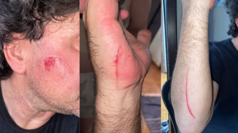 Motorista de aplicativo é atacado com facão por passageiro durante corrida em Toledo