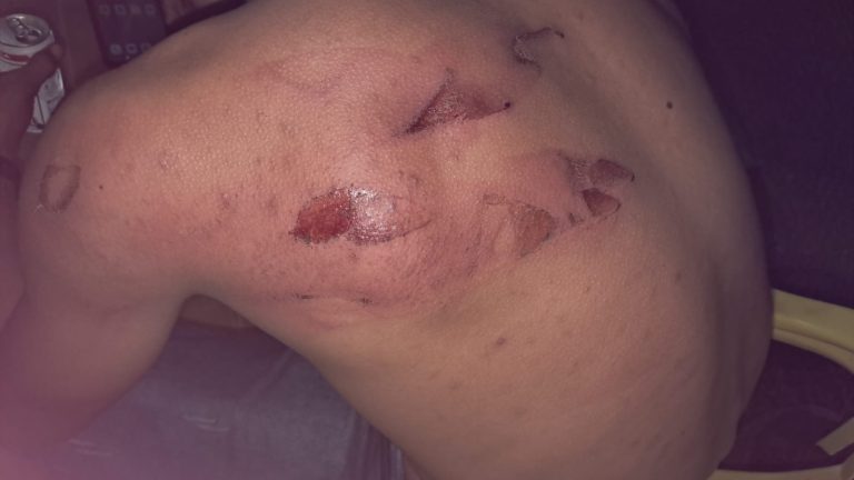 Trabalhadores denunciam agressões com facão e ameaças armadas em alojamento de Nova Guarita; veja imagens.