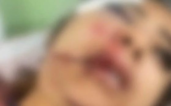 Homem é preso em flagrante após espancar garota de programa e deixá-la inconsciente em Várzea Grande; veja vídeo